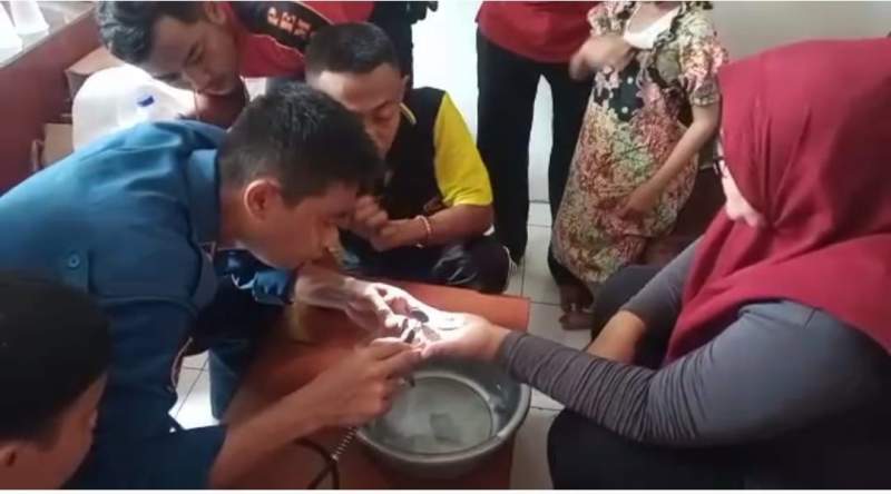 BPBD Kabupaten Tangerang Eksekusi Cincin Tersangkut di Jari Manis Ibu Rumah Tangga