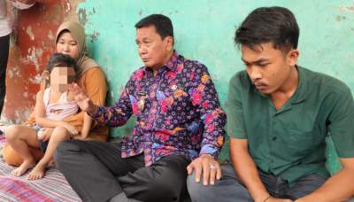 Bupati Tangerang Bantu Penuh Balita Penderita Kanker Mata